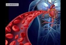 心血管科主任：5種行為最易讓血管老化，教您1招讓血管返老還童