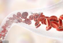 此時是血管保養最關鍵的時期！多吃它血管永年輕