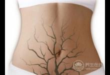 熊畫健康：國民好老公讓她沒有發“炎”權