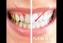 刷牙到底用熱水還是冷水好？搞錯(cuò)這一點(diǎn)，難怪天天刷牙還是大黃牙