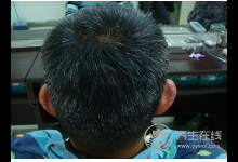 擔心白發一直冒出來?4大養發食物告訴你