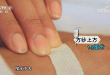 輸液后按壓方法不當 易造成手背淤青！