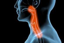 總是想清嗓子是怎么回事？ 保護(hù)嗓子有絕招