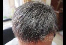 3種食物吃太多,白發、掉發就會找上門!