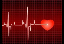 心跳過(guò)快可以吃點(diǎn)什么食物？