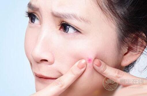臉上長痘痘吃什么好? 臉上長痘痘吃什么好?