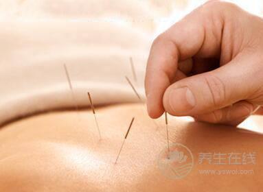 針灸減肥有效嗎針灸減肥有關的知識 針灸減肥有效嗎針灸減肥有關的知識