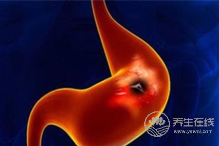 胃酸過(guò)多早餐該吃什么好 胃酸過(guò)多早餐該吃什么好