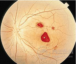 這兩類食物很毒,最容易導(dǎo)致肝癌,很多人還不注意 這兩類食物很毒,最容易導(dǎo)致肝癌,很多人還不注意
