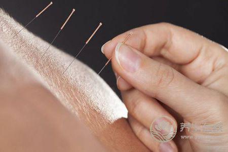 針灸減肥效果好不好呢 針灸減肥效果好不好呢