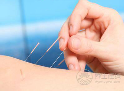 針灸減肥有效嗎針灸減肥有關的知識 針灸減肥有效嗎針灸減肥有關的知識