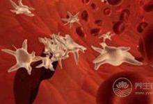 如何祛斑效果最好 試試八款祛斑食療偏方