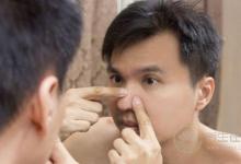 假期飲食不當竟會惹上皮膚病?節后調理身體需注意4點