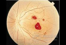 這兩類食物很毒，最容易導致肝癌，很多人還不注意