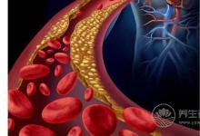 午飯后適合做什么?