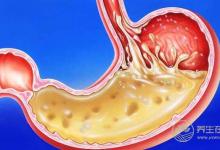 胃脹、胃酸、胃不舒服?簡(jiǎn)單6招,還自己一個(gè)好胃