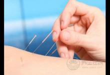 針灸減肥有效嗎針灸減肥有關(guān)的知識(shí)