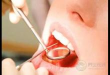 得了口腔潰瘍怎么好得快?