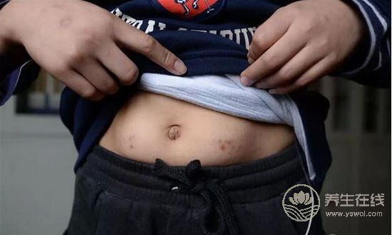 一段簡單的降糖經(jīng)歷,用樹葉泡水喝,花錢少效果好 一段簡單的降糖經(jīng)歷,用樹葉泡水喝,花錢少效果好