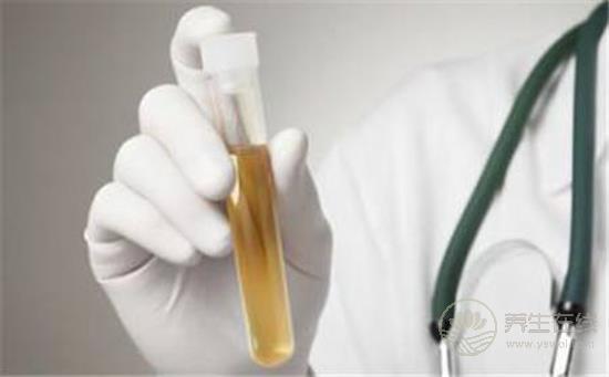 尿液發黃像濃茶？小心是肝膽出了問題！