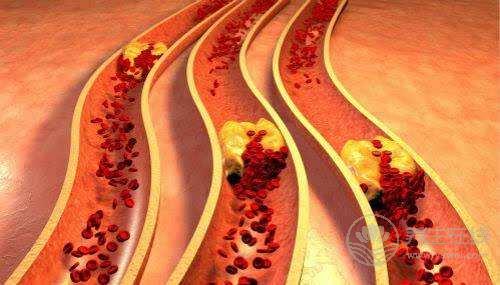 這些清理血管的特效食物,35歲以后一定要多吃 這些清理血管的特效食物,35歲以后一定要多吃