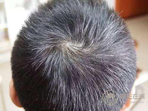 早生華發,試試枸杞,能幫你找回黑發 早生華發,試試枸杞,能幫你找回黑發