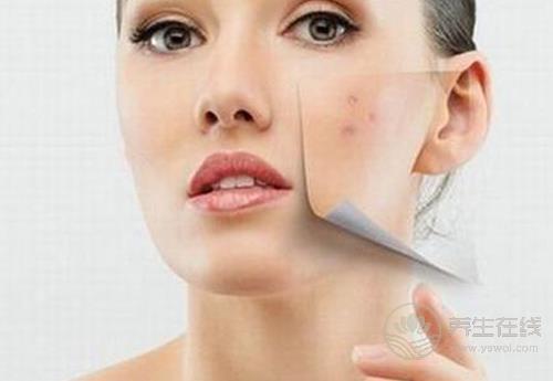 痘痘星人看過來,這3種食物咱別吃了,再好吃為了美也要忍 痘痘星人看過來,這3種食物咱別吃了,再好吃為了美也要忍