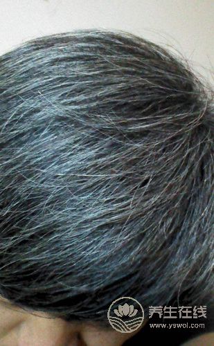 想要白發變黑發,需要做好5點 想要白發變黑發,需要做好5點