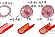 泡腳水加點(diǎn)姜，能有想不到的功效