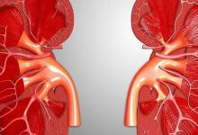 補(bǔ)血補(bǔ)氣的食物有哪些？