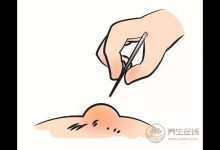 燙傷了怎么辦？6個(gè)處理誤區(qū)，還有很多人用