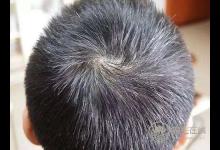 早生華發,試試枸杞,能幫你找回黑發