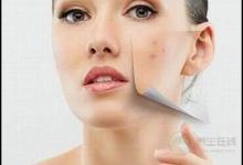 痘痘星人看過來，這3種食物咱別吃了，再好吃為了美也要忍