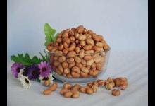 八旬老人吃紅棗心臟驟停,切忌養(yǎng)生要適當(dāng)