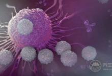 甜食是腫瘤的養料,癌細胞瘋長,癌癥很快就晚期了!