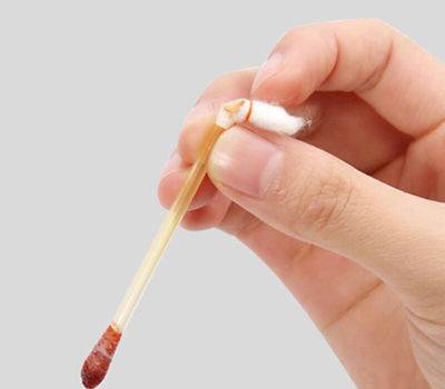 當身體出現傷口可以用碘伏消毒嗎 當身體出現傷口可以用碘伏消毒嗎