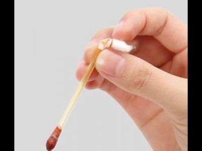 當(dāng)身體出現(xiàn)傷口可以用碘伏消毒嗎