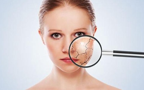 當(dāng)皮膚出現(xiàn)干裂的情況應(yīng)該如何處理 當(dāng)皮膚出現(xiàn)干裂的情況應(yīng)該如何處理