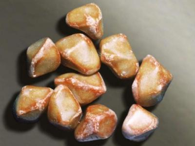 膽固醇結(jié)石要采取怎樣的方法治療