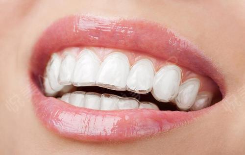 牙齦破了之后如何處理更容易恢復-易網健康<a href=http://www.xllyou.com/jkys/ target=_blank class=infotextkey>養生</a>網 牙齦破了之后如何處理更容易恢復