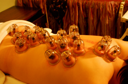 拔罐需要注意哪些方面又存在著哪些禁忌-易網健康<a href=http://www.xllyou.com/jkys/ target=_blank class=infotextkey>養生</a>網 拔罐需要注意哪些方面又存在著哪些禁忌