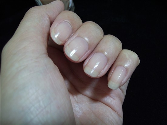 指甲的保護(hù)方法指甲豎著裂開的原因-易網(wǎng)健康<a href=http://www.xllyou.com/jkys/ target=_blank class=infotextkey>養(yǎng)生</a>網(wǎng) 指甲的保護(hù)方法指甲豎著裂開的原因