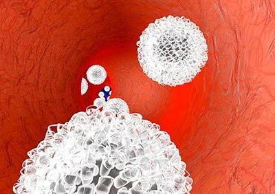 造成人體內(nèi)白血球比例過高的原因