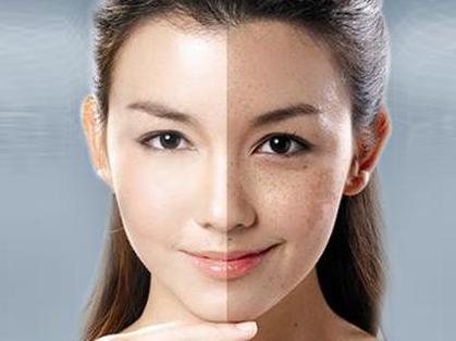 臉上長斑要怎樣可以去除臉上的斑點(diǎn)-易網(wǎng)健康<a href=http://www.xllyou.com/jkys/ target=_blank class=infotextkey>養(yǎng)生</a>網(wǎng) 臉上長斑要怎樣可以去除臉上的斑點(diǎn)