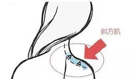 斜方肌可以通過按摩的方式消除嗎-易網(wǎng)健康<a href=http://www.xllyou.com/jkys/ target=_blank class=infotextkey>養(yǎng)生</a>網(wǎng) 斜方肌可以通過按摩的方式消除嗎