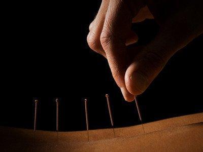 針灸的針扎在身上的時候會不會疼