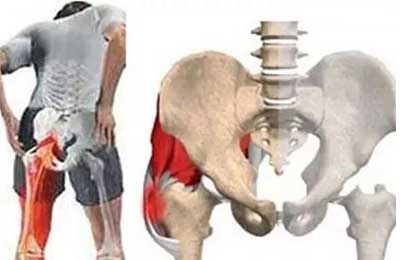 股骨頭壞死這種疾病是否屬于遺傳病-易網健康<a href=http://www.xllyou.com/jkys/ target=_blank class=infotextkey>養(yǎng)生</a>網 股骨頭壞死這種疾病是否屬于遺傳病