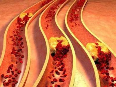 血脈通膠囊會對身體產生哪些副作用