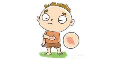 劃痕性蕁麻疹的病因以及適合吃什么