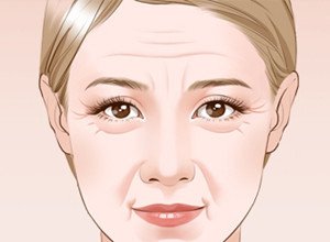 能夠有效去除面部皺紋的幾個方法-易網健康<a href=http://www.xllyou.com/jkys/ target=_blank class=infotextkey>養生</a>網 能夠有效去除面部皺紋的幾個方法